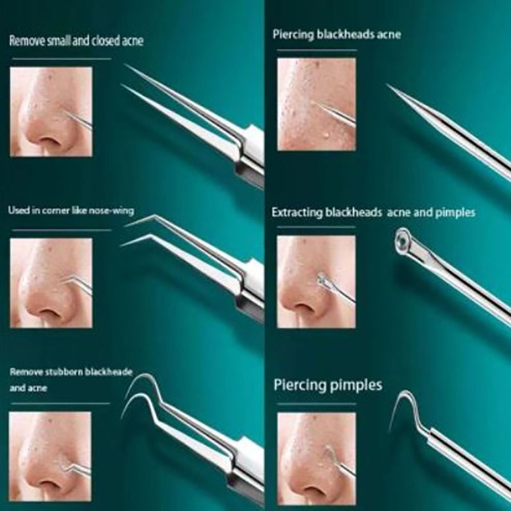 8-in-1 Blackhead & Acne Remover Tool Kit
