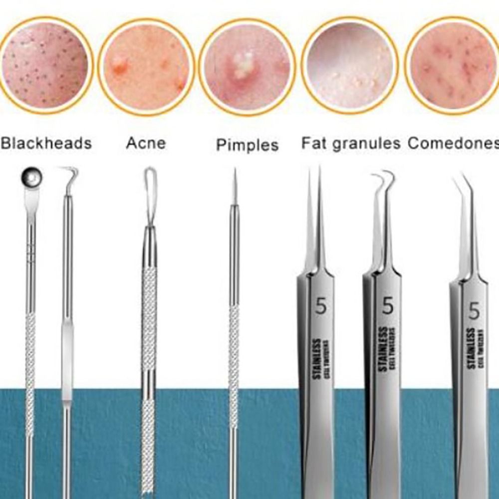 8-in-1 Blackhead & Acne Remover Tool Kit