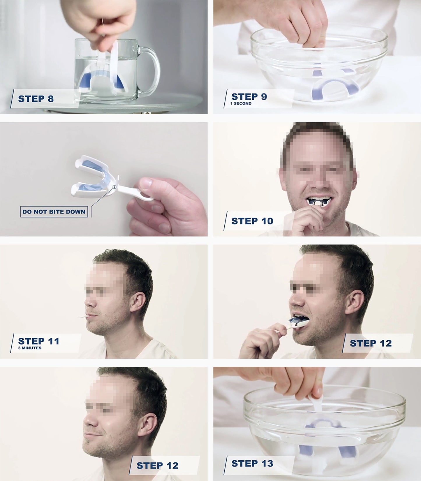 Night Guard for Teeth Grinding (Bruxism)